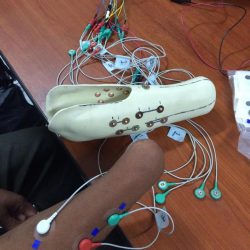 Part of prosthetic leg and many colored wires on a table connected to an amputated arm